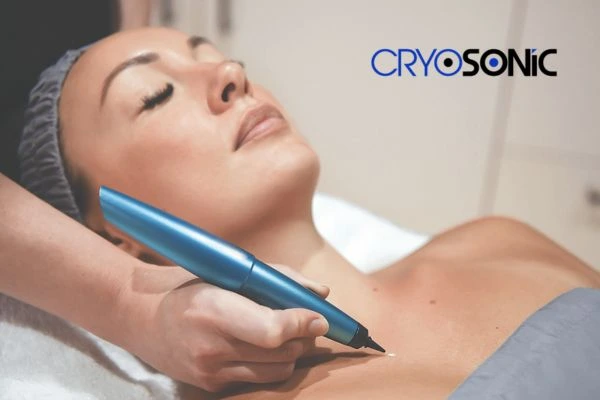 Cryosonic lesion removal prices book today! Northampton