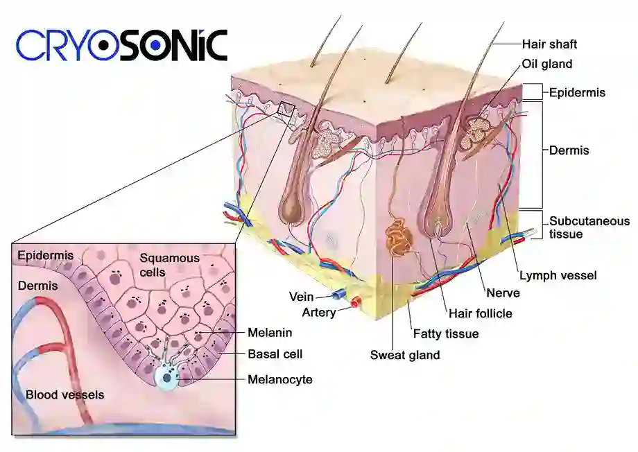 How Cryotherapy Stimulates Melanocyte Activity Northampton